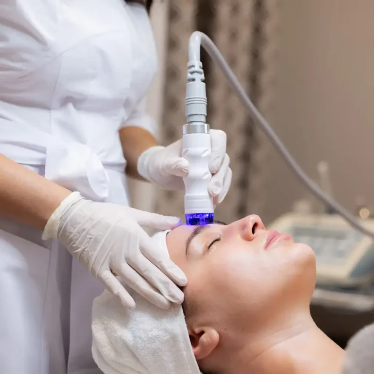 therapeia-microneedle-rf